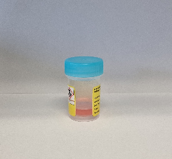 Gefaesse für Urin Cytologie