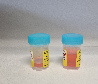 Gefaesse für Urin Cytologie-0