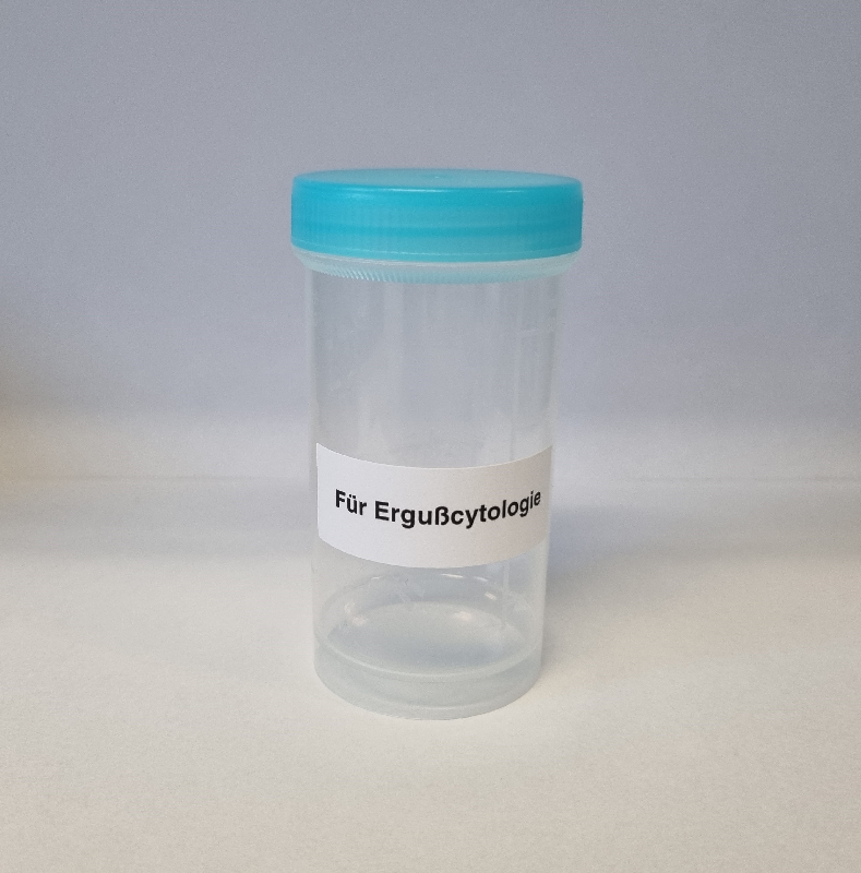 Für Ergußcytologie